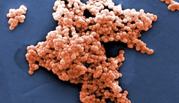 Streptococcus baktérium