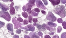 A mycoplasma kórokozója